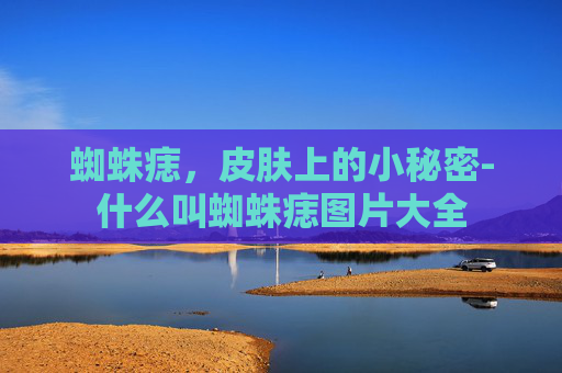蜘蛛痣,皮肤上的小秘密-什么叫蜘蛛痣图片大全 蜘蛛痣,皮肤上的小秘密-什么叫蜘蛛痣图片大全
