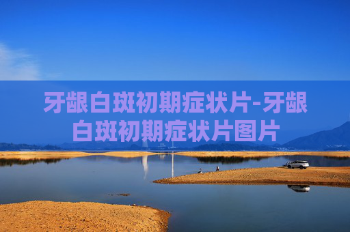 牙龈白斑初期症状片-牙龈白斑初期症状片图片 牙龈白斑初期症状片-牙龈白斑初期症状片图片