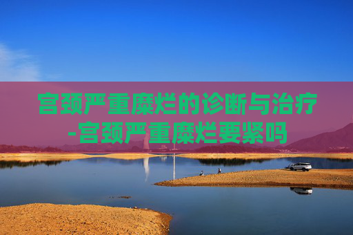 宫颈严重糜烂的诊断与治疗-宫颈严重糜烂要紧吗 宫颈严重糜烂的诊断与治疗-宫颈严重糜烂要紧吗