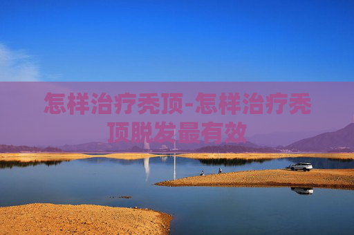 怎样治疗秃顶-怎样治疗秃顶脱发最有效