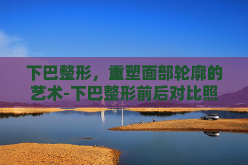 下巴整形，重塑面部轮廓的艺术-下巴整形前后对比照片