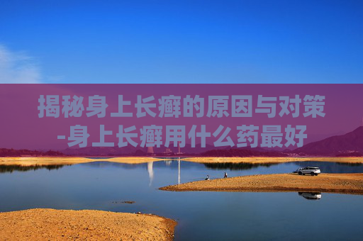 揭秘身上长癣的原因与对策-身上长癣用什么药最好